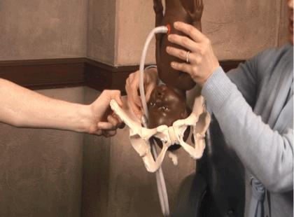 她破水后差点失去了宝宝,幸好没耽误1分钟!