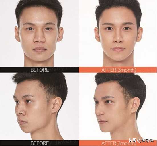 一个长得丑的男生,怎样才能全方位地变帅,改造自己?