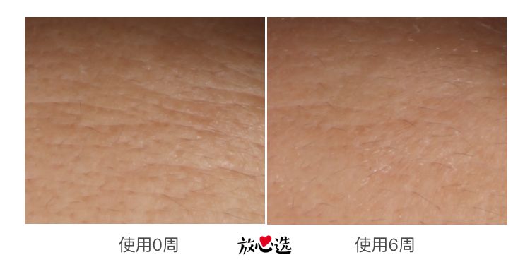 雅诗兰黛小棕瓶精华怎么购买划算,雅诗兰黛15元测评