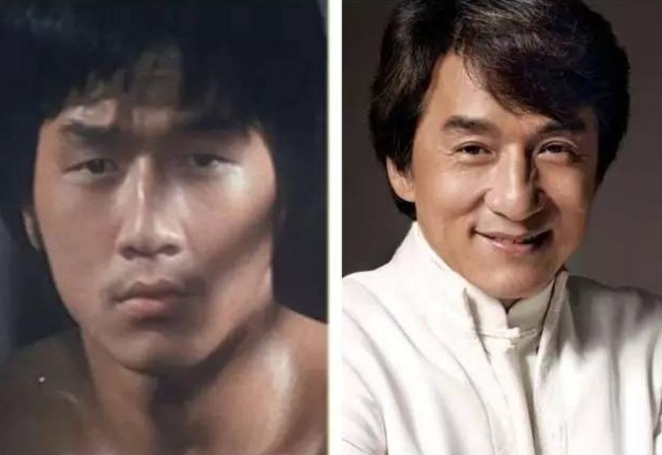 男生小眼睛割双眼皮前后对比,男生割双眼皮多久恢复自然