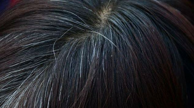 痘痘的防治方法有哪些,痘痘种类及去除办法