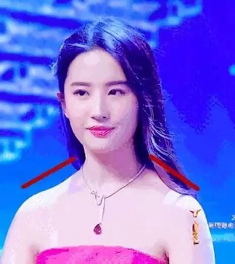 明星溜肩矫正前后,缩肩的危害