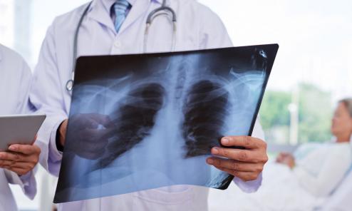 肺结节明确是肺癌要不要立马手术,肺结节离肺癌有多远你必须要知道