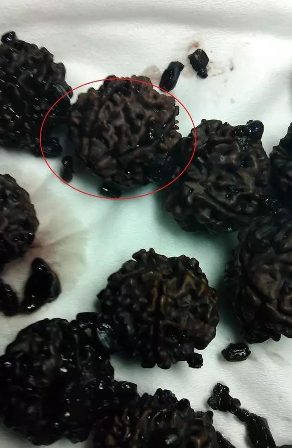 神明液体+鸡蛋+核桃油+白醋！上锅焖2个小时！让人大吃一惊