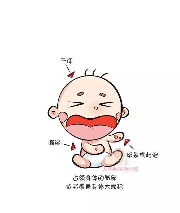 热疹皮疹湿疹有什么区别,湿疹和荨麻疹有什么区别怎样判断