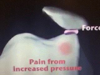 哪些疾病会出现膝关节疼痛的表现,膝关节疼痛原因平时应该在意哪些