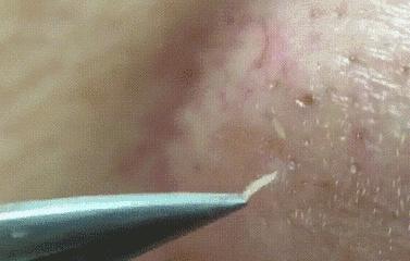 宋威龙对赵露思的评价,宋威龙痘痘肌