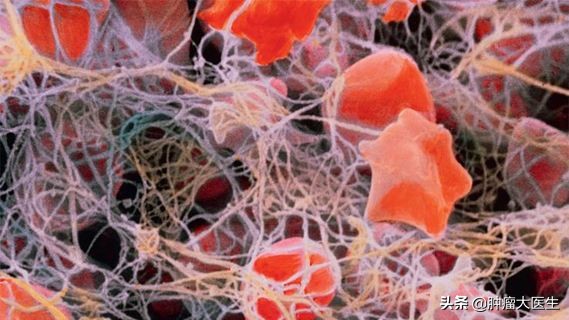 不查不知道一查吓一跳的肿瘤标志物到底预示什么病？