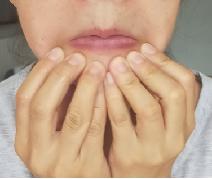 面部肌肉松弛怎么锻炼变紧,面部肌肉松弛怎么办快速恢复