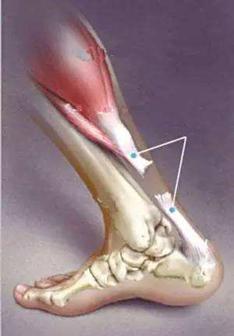 易建联跟腱受伤好了吗,易建联跟腱受伤完整版
