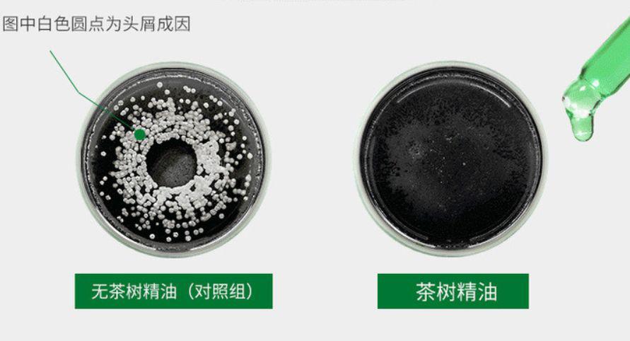 去头屑去螨虫哪个洗发水最有效,去头屑去螨虫用哪个洗发水最有效