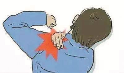 肩周炎锻炼小方法,肩周炎打封闭针后多久可以锻炼