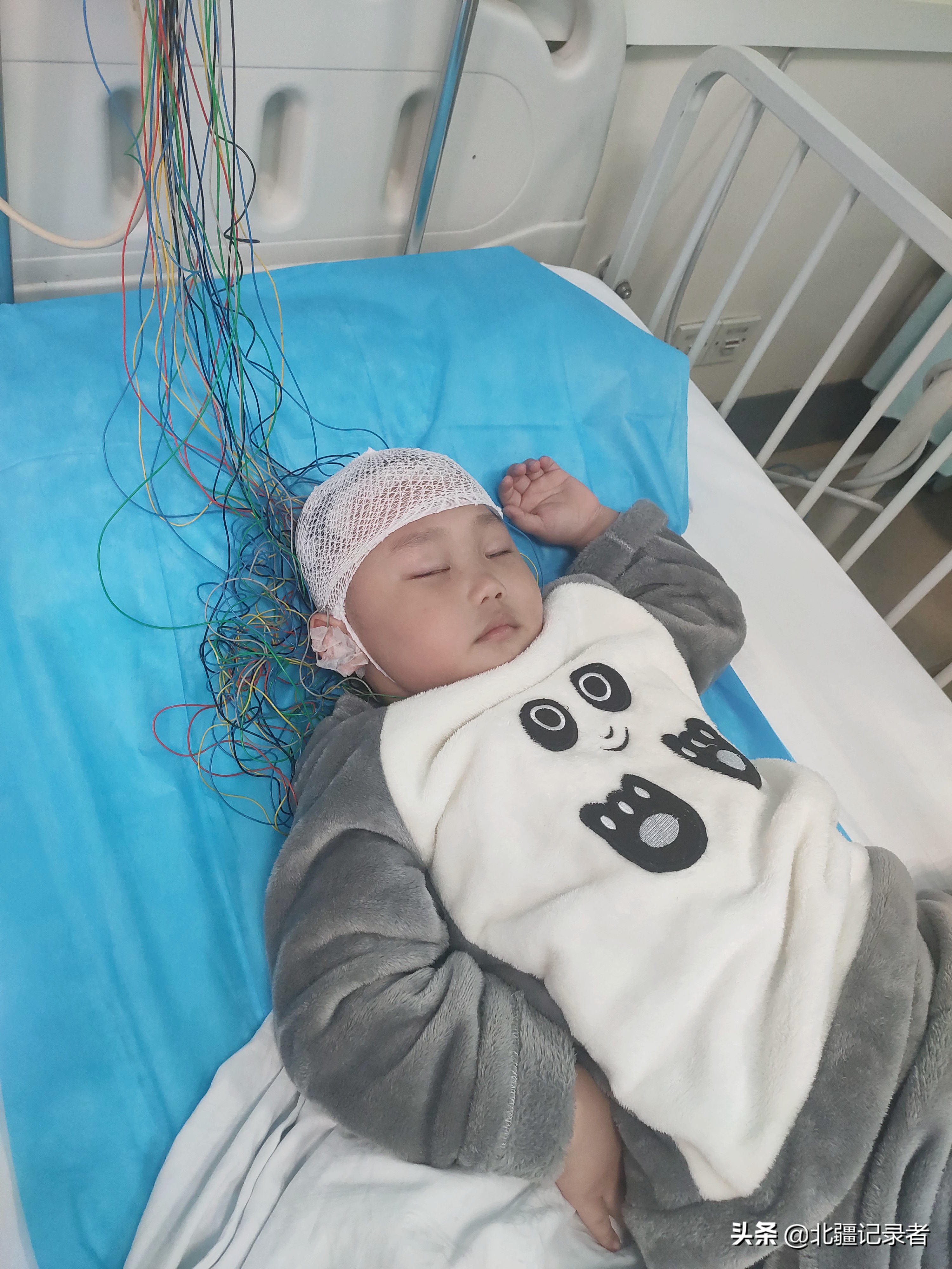 小孩咳嗽厉害突然死亡,孩子因为支气管肺炎住院的视频