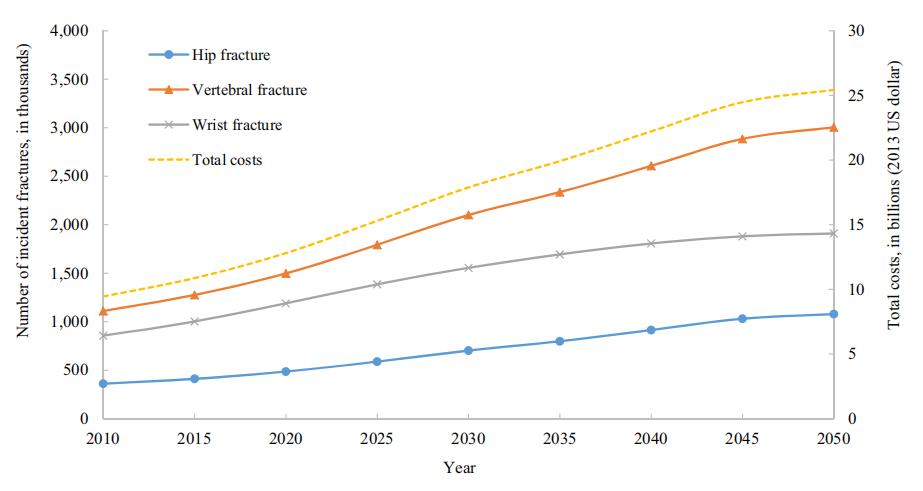 中老年人骨质流失怎么调理,老年人骨钙流失超过多少