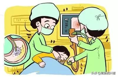 无痛胃镜需要注意什么事项吗,做无痛胃镜有什么禁忌吗