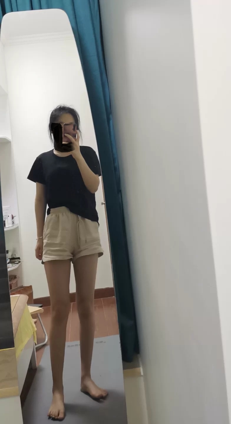 17岁高中生甲亢能彻底治愈吗,20岁小姑娘患上甲亢会治愈吗