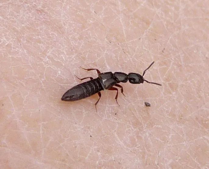 野外郊游怎样防蚊虫叮咬,夏季虫子叮咬科普视频