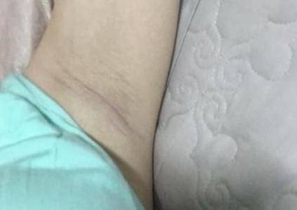 怀孕期间吃黑豆胎儿会变黑吗,孕妈妈为什么怀孕晚期皮肤黑了