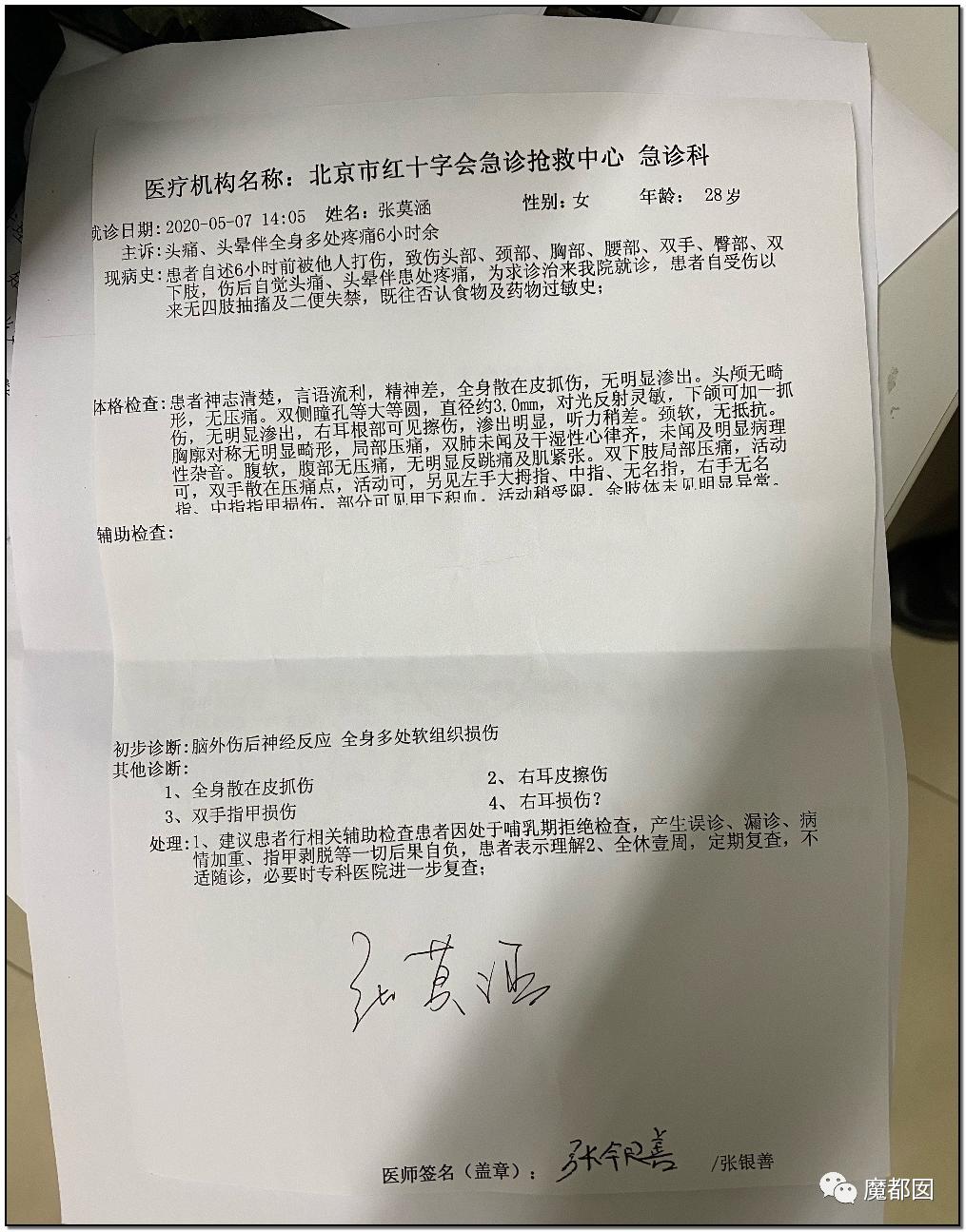 短跑名将张培萌被曝家暴反转,短跑名将张培萌家暴背后