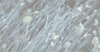 床单久睡不晒螨虫“成堆”？教你1招，不用洗不用晒，轻松除螨虫