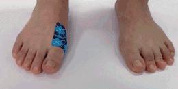 运动防止起水泡,预防长时间走路起水泡