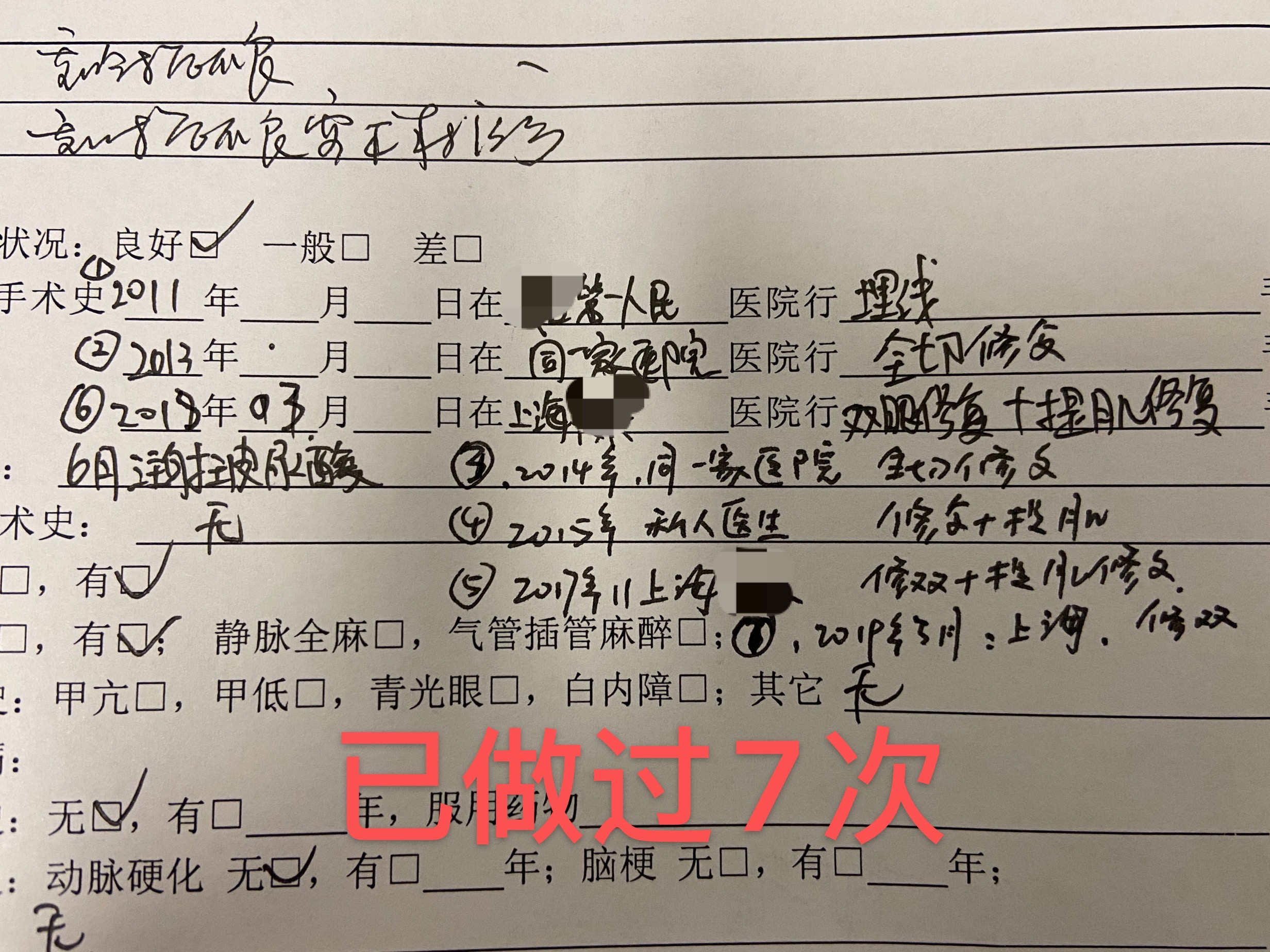 高难度修复双眼皮宽改窄恢复期,高难度双眼皮修复案例