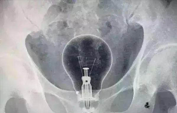 “菊花”不适，不一定都是“痔疮”的锅