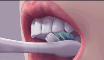 各种治牙方法疼痛分级,牙疼痛要警惕四种病