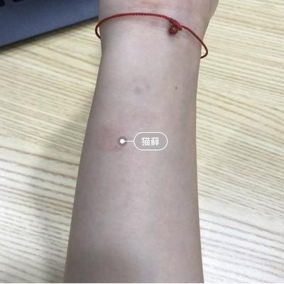 啮齿类宠物真菌感染,引起宠物传染病的微生物有哪些