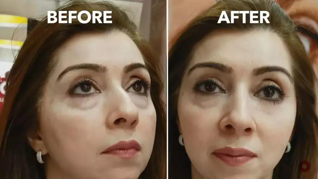 补水保湿淡化黑眼圈眼袋,黑眼袋黑眼圈用什么护肤品消除