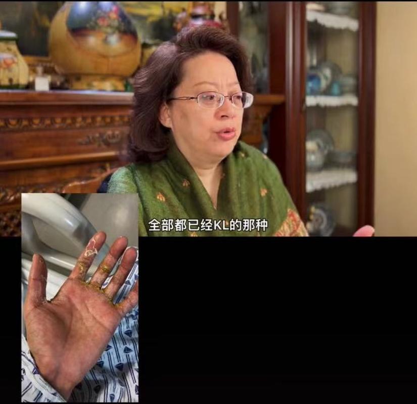 患淋巴癌的网红,男网红消失半年患淋巴癌