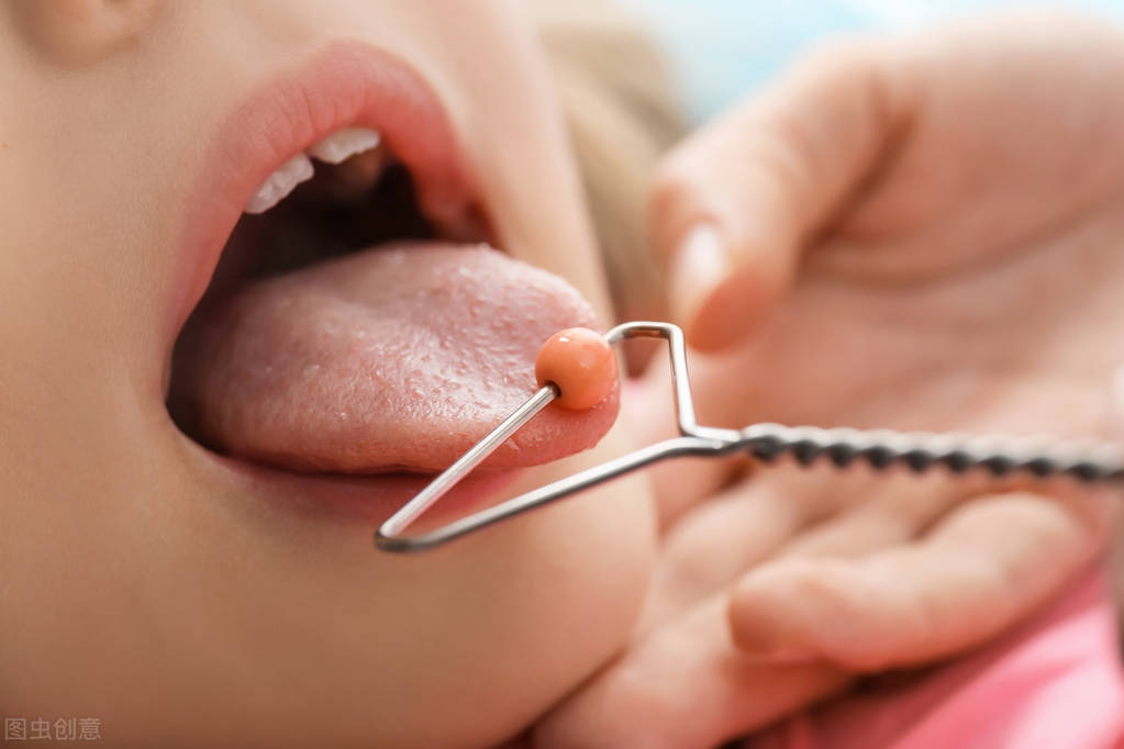 口吃的原因是什么应该如何矫治,讲话口吃是什么原因