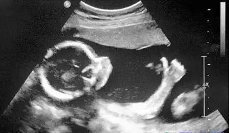 x光b超ct核磁共振区别,收藏这篇就够了