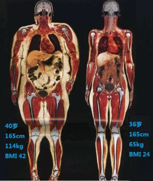 生育损害,生育后做哪些产后修复