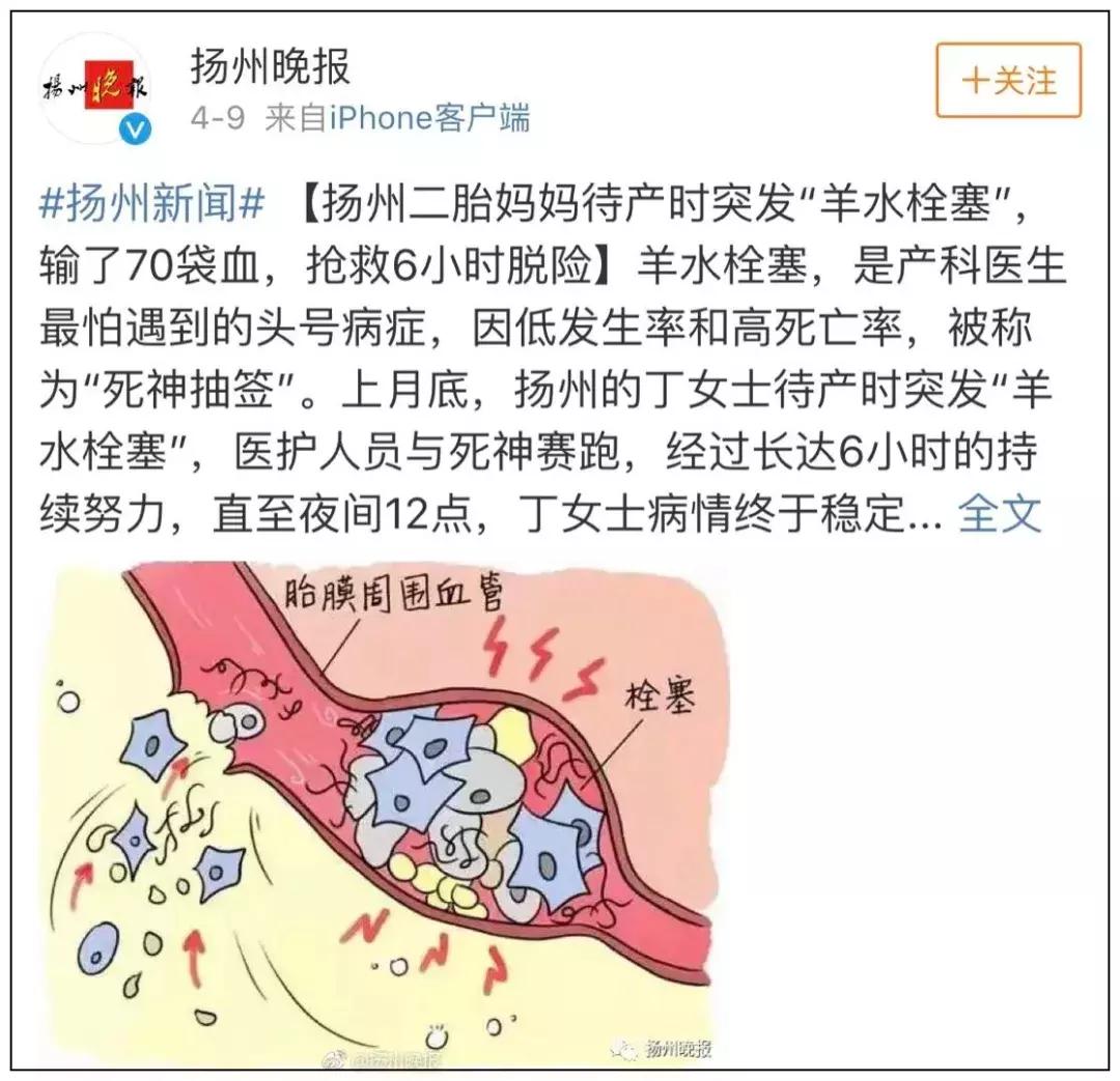 明星产后尿失禁怎么治疗,女明星产后的巨大变化
