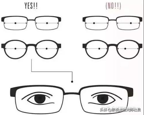 戴上近视眼镜头晕怎么回事,换了眼镜头晕多久能适应