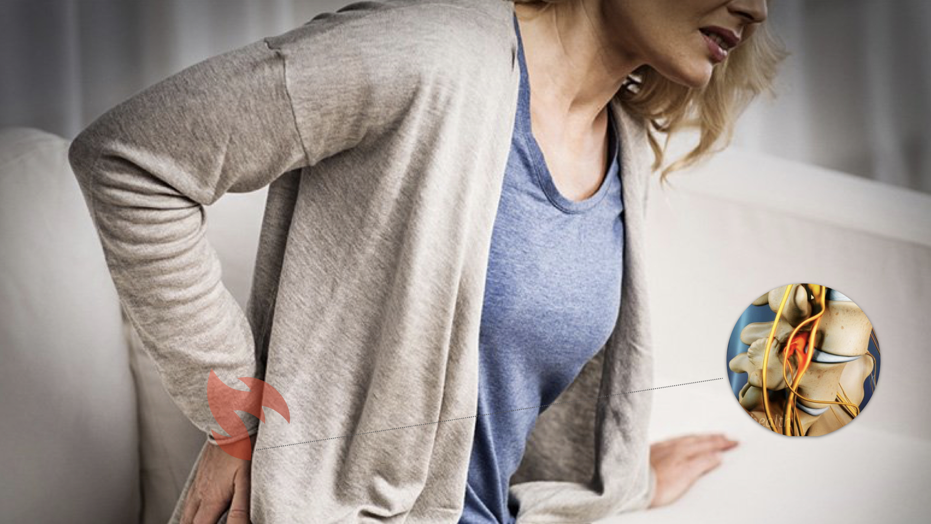 椎间盘的恢复,椎间盘恢复生理曲度方法