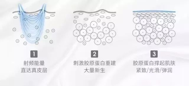 小茂肌诊室∣美容仪挑战：家用美容仪到底值得投资吗？