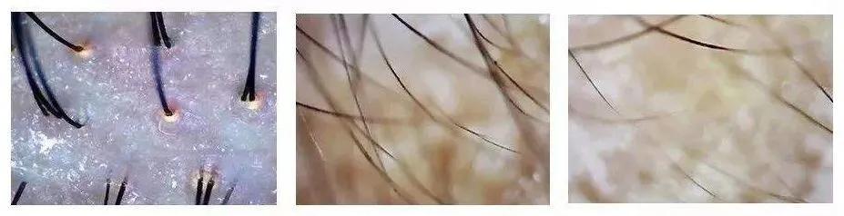 明星亲测生发液,明星亲测养生