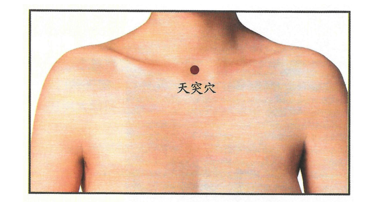 风寒咳嗽的艾灸治疗,风寒咳嗽艾灸哪个穴位可以止咳