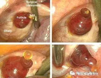 排卵试纸测不出来排卵怎么办,排卵试纸怎么测排卵最准