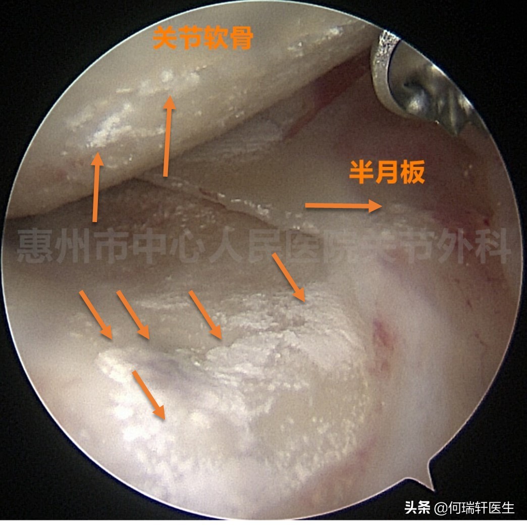 醒来膝盖不对劲怎么回事,醒来膝盖后面疼