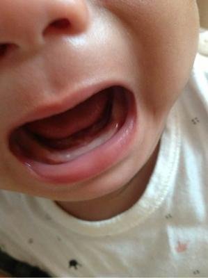 宝宝体重太轻怎么办,宝宝体重减轻不长肉