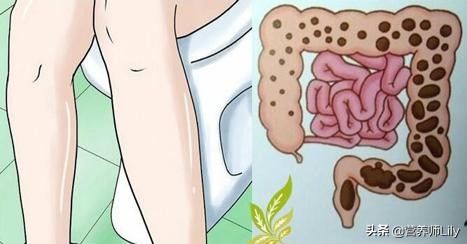 排便不好的人要少吃什么多吃什么,排便不好要吃什么药管用