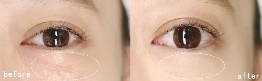 眼霜有必要用好一点的么,眼霜一般有没有用