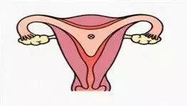 卵巢早衰来势汹汹？这5点是早衰“信号灯”，女性快自查