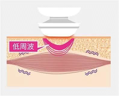 初普射频美容仪测评,家用射频美容仪哪个品牌最好