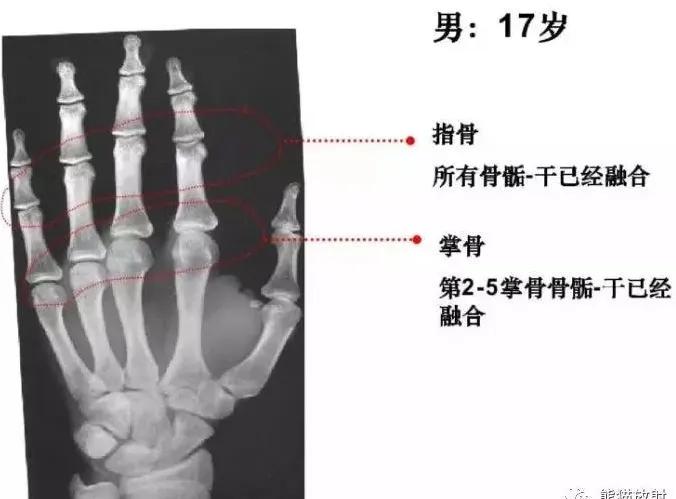 孩子个子高却跑不快,小孩个头不高