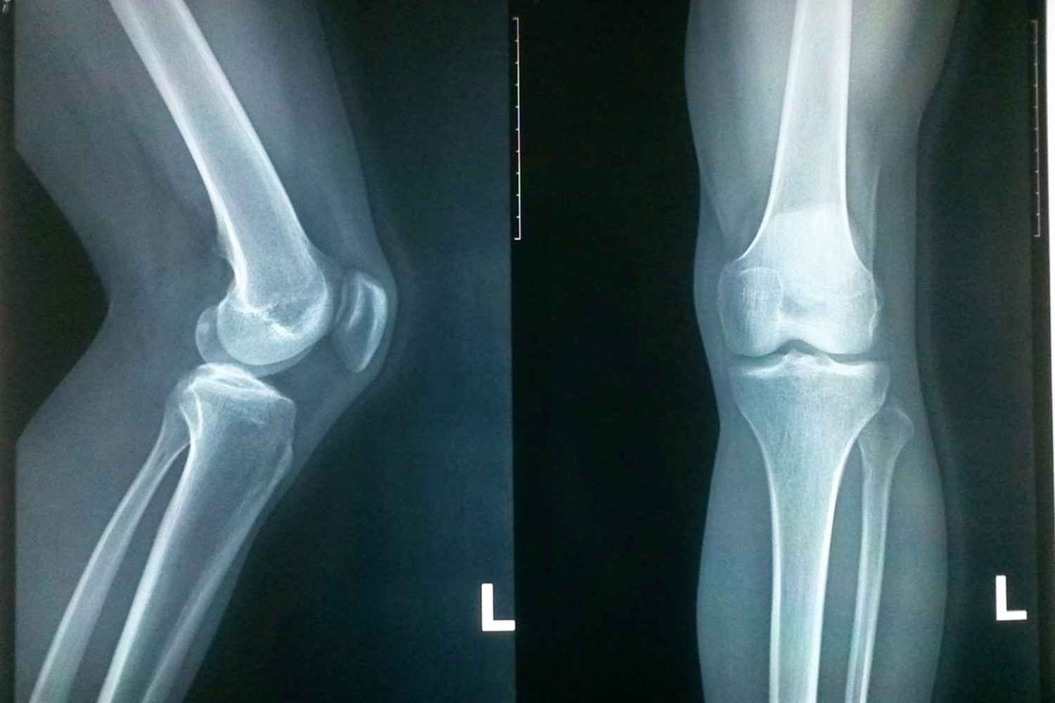 父母个子矮孩子可以长到一米九吗,小学生吃什么直接长到一米九