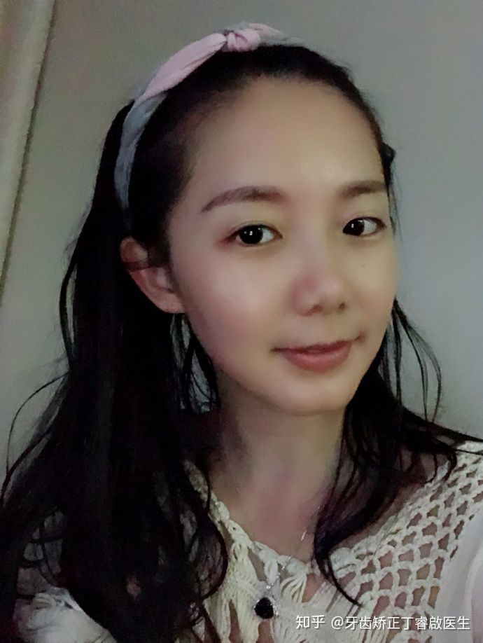 隐适美牙套矫正手法,隐适美牙套矫正的全过程